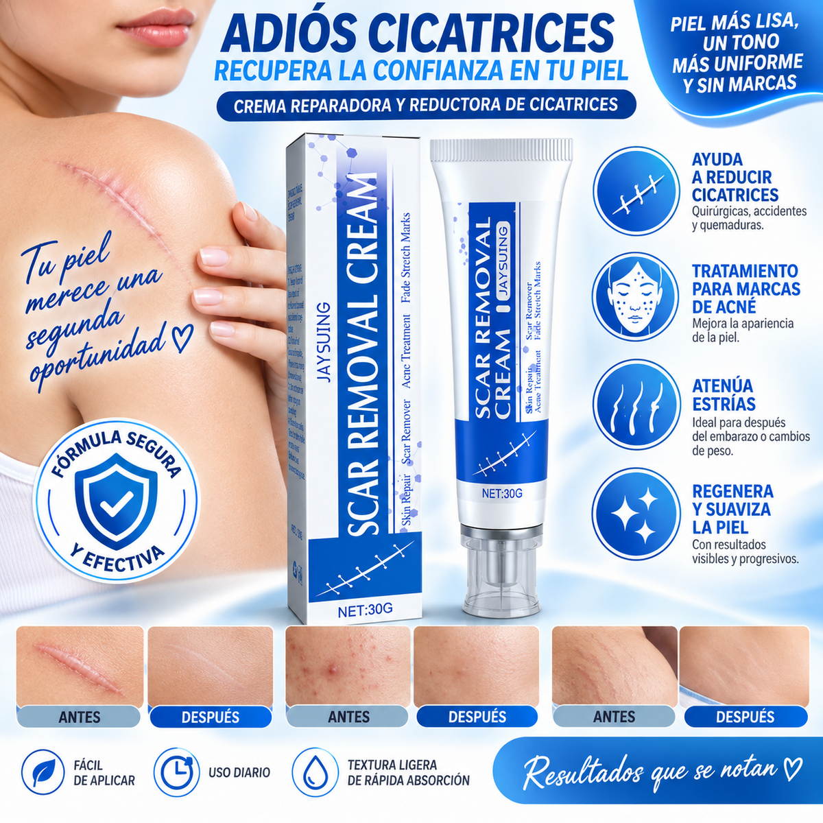 Crema para Cicatrices y Marcas de Acne